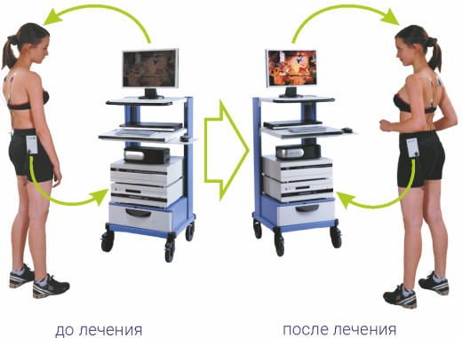 Комплекс для коррекции осанки и лечения начальных стадий сколиоза «Оскор»